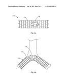 FRAME-BASED VENA CAVA FILTER diagram and image