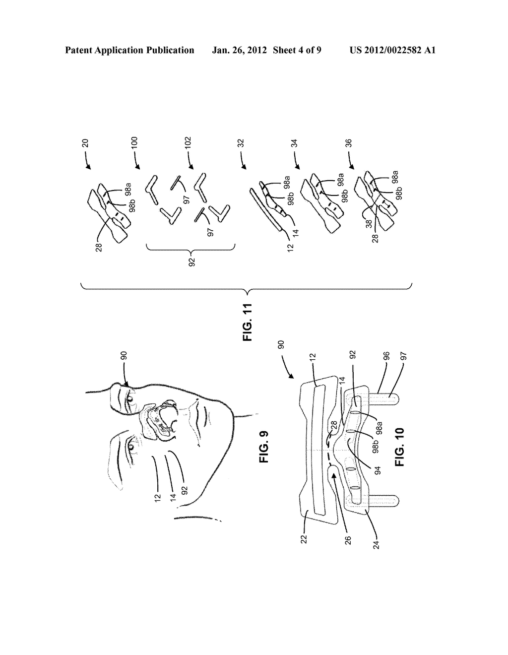 NASAL DILATOR - diagram, schematic, and image 05