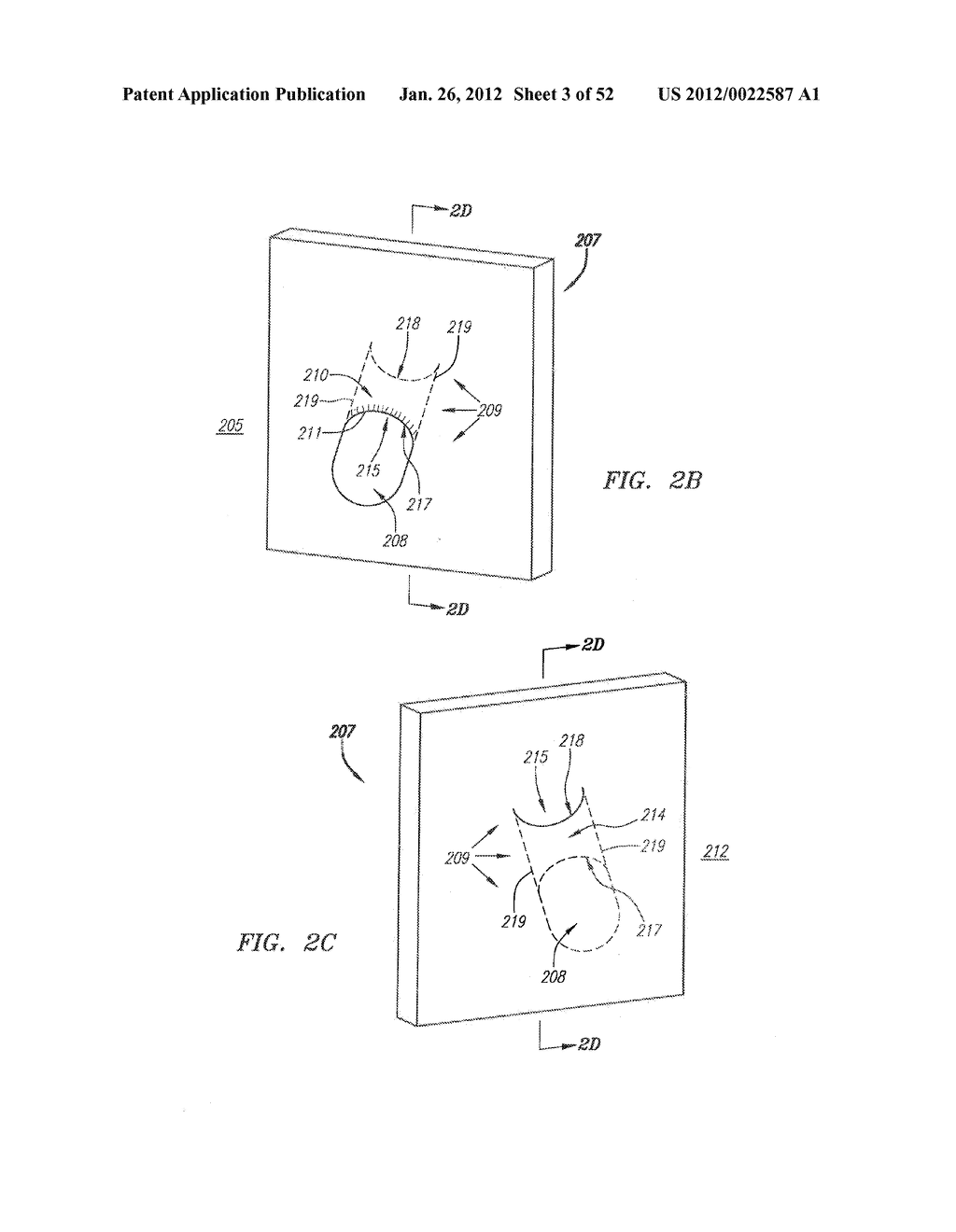 Systems and Methods for Treating Septal Defects - diagram, schematic, and image 04