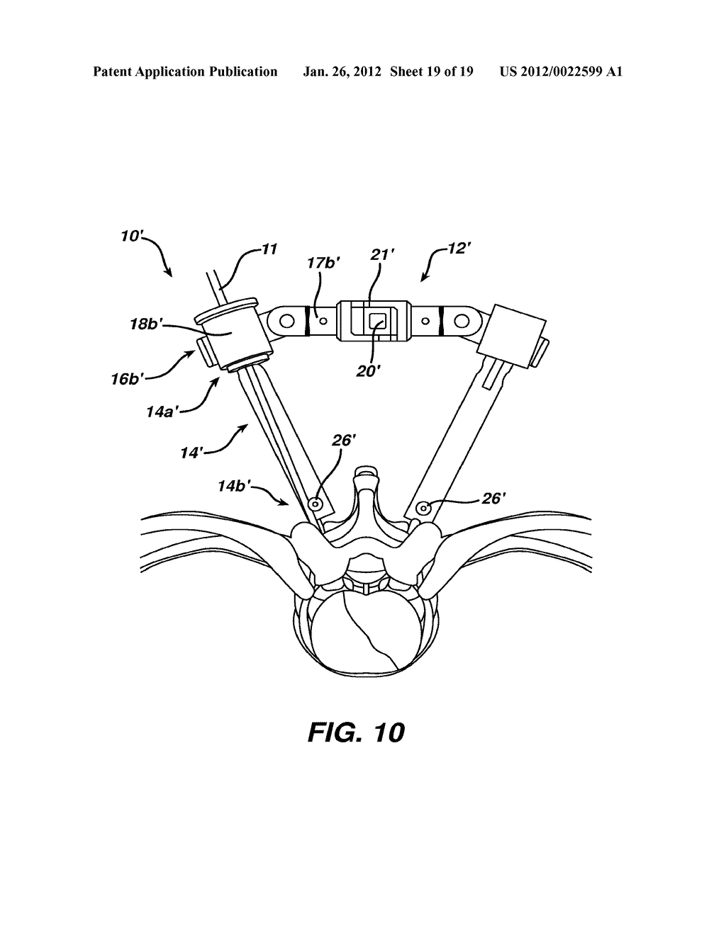 MINIMALLY INVASIVE SPINAL FIXATION GUIDE SYSTEMS AND METHODS - diagram, schematic, and image 20