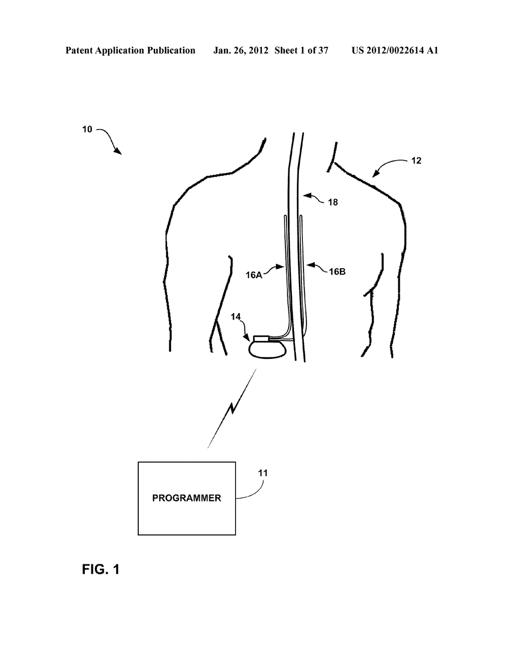 SHIFTING BETWEEN ELECTRODE COMBINATIONS IN ELECTRICAL STIMULATION DEVICE - diagram, schematic, and image 02