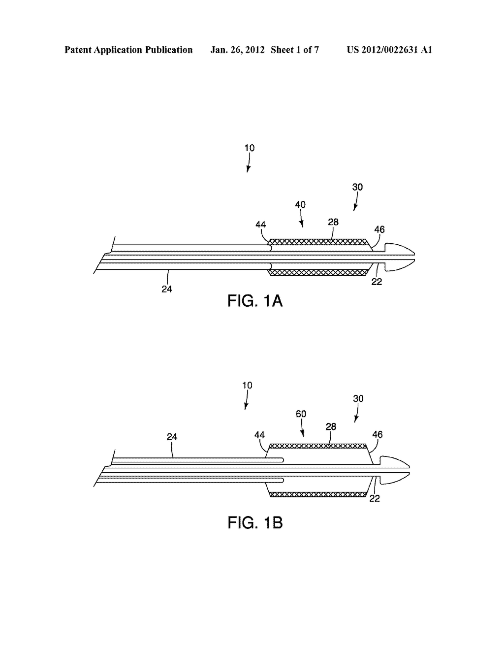 Control System for a Stent Delivery System - diagram, schematic, and image 02