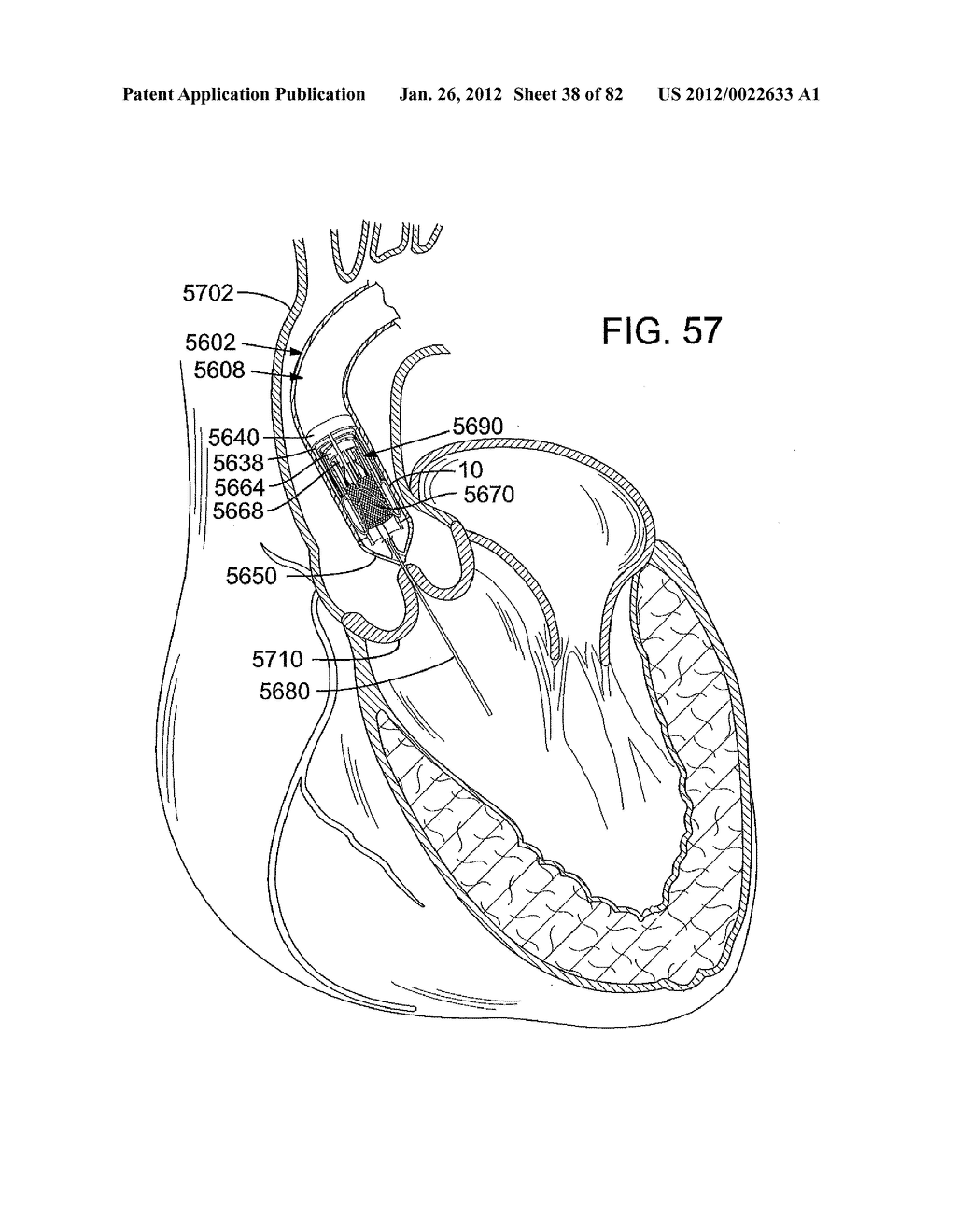 RETAINING MECHANISMS FOR PROSTHETIC VALVES - diagram, schematic, and image 39