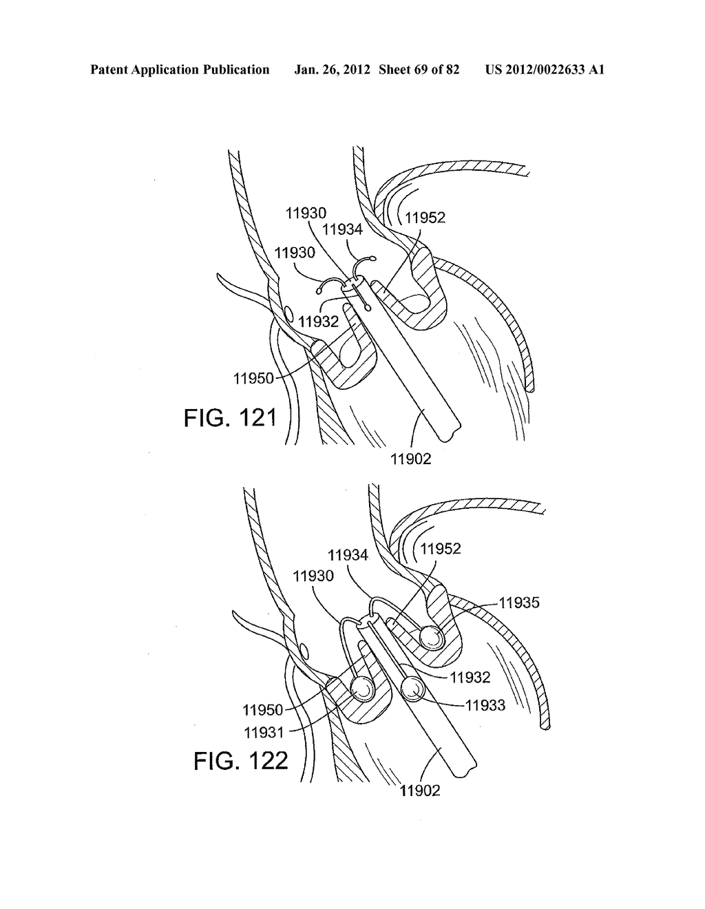 RETAINING MECHANISMS FOR PROSTHETIC VALVES - diagram, schematic, and image 70