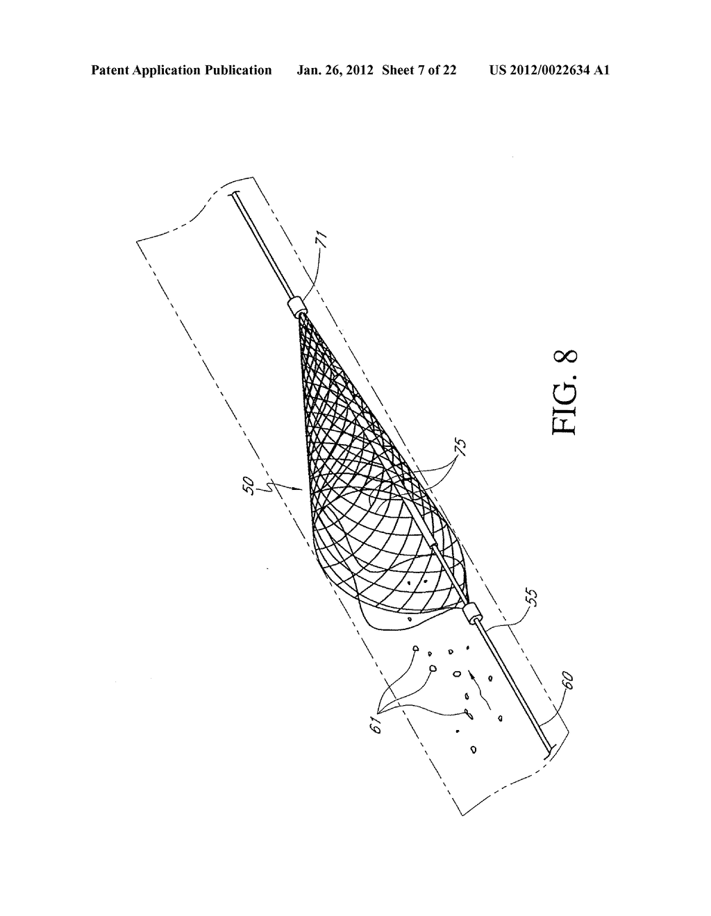 MEDICAL DEVICES WITH AMORPHOUS METALS AND METHODS THEREFOR - diagram, schematic, and image 08