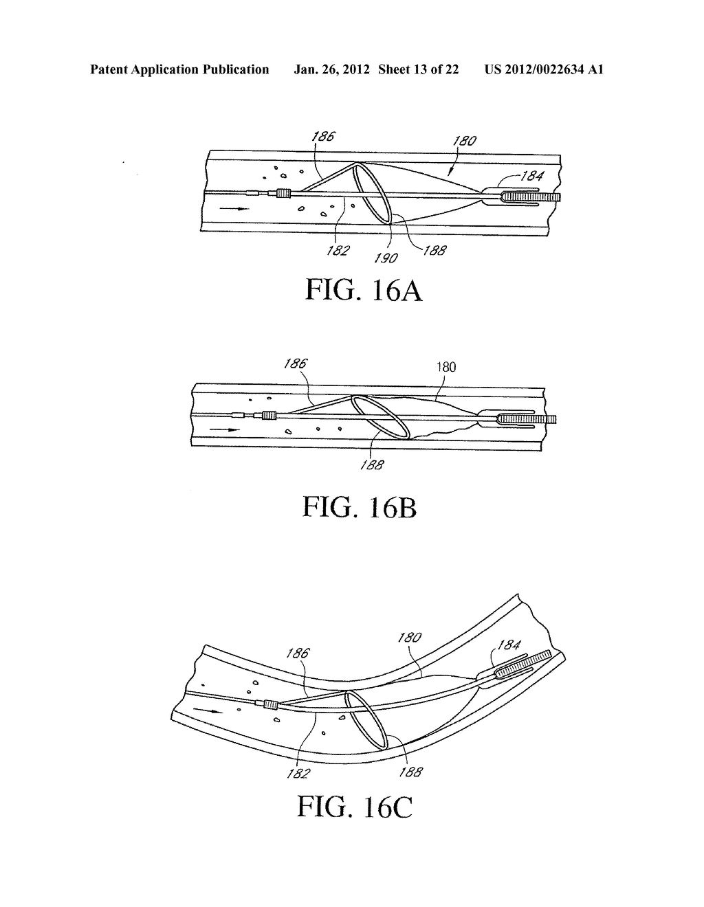 MEDICAL DEVICES WITH AMORPHOUS METALS AND METHODS THEREFOR - diagram, schematic, and image 14