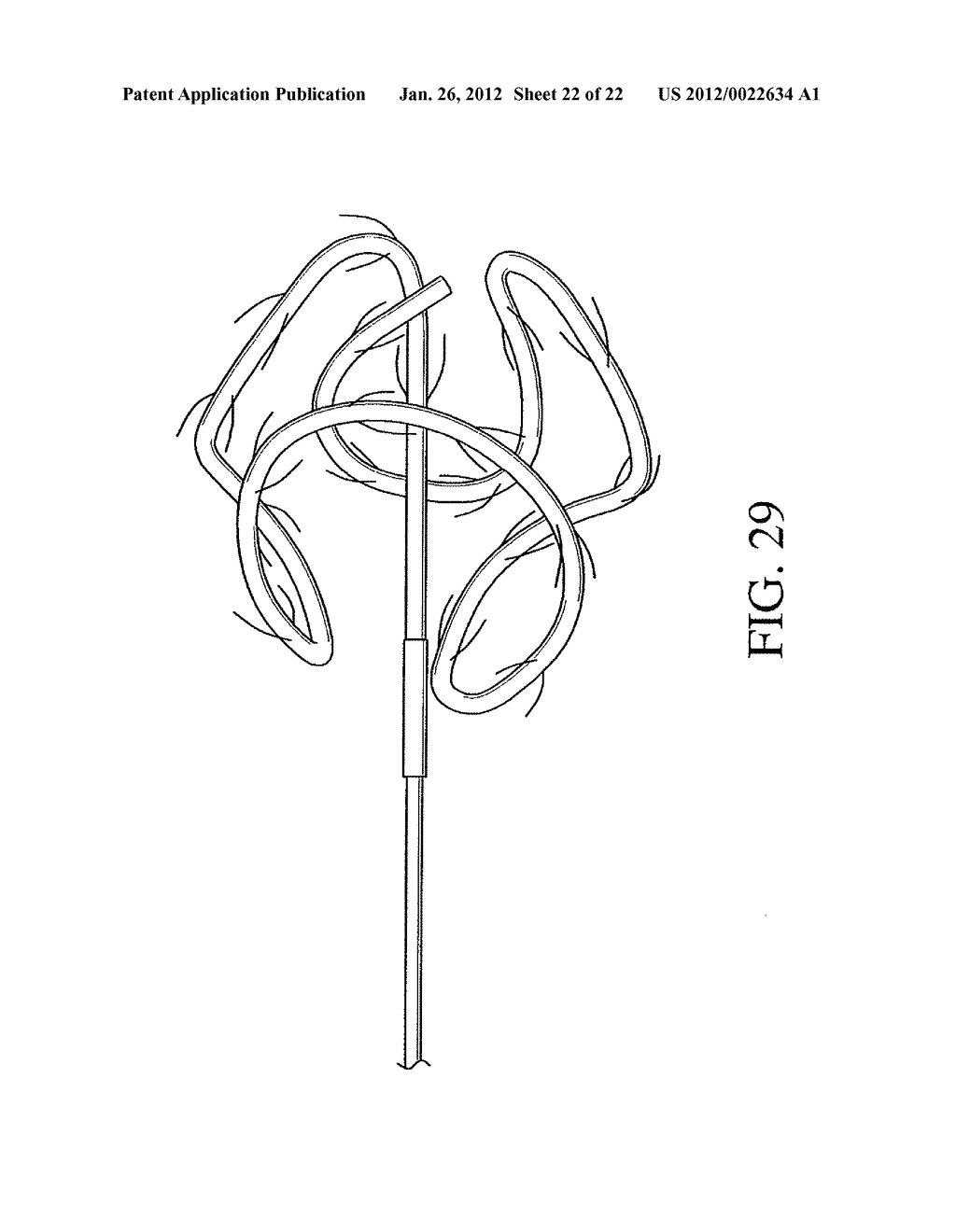 MEDICAL DEVICES WITH AMORPHOUS METALS AND METHODS THEREFOR - diagram, schematic, and image 23