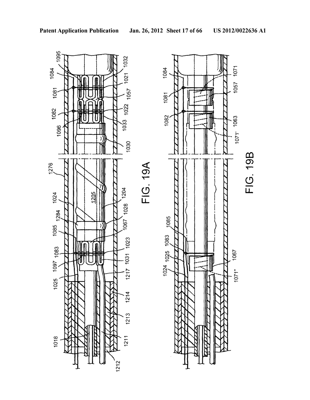 METHOD OF DELIVERING ADVANCED ENDOVASCULAR GRAFT - diagram, schematic, and image 18