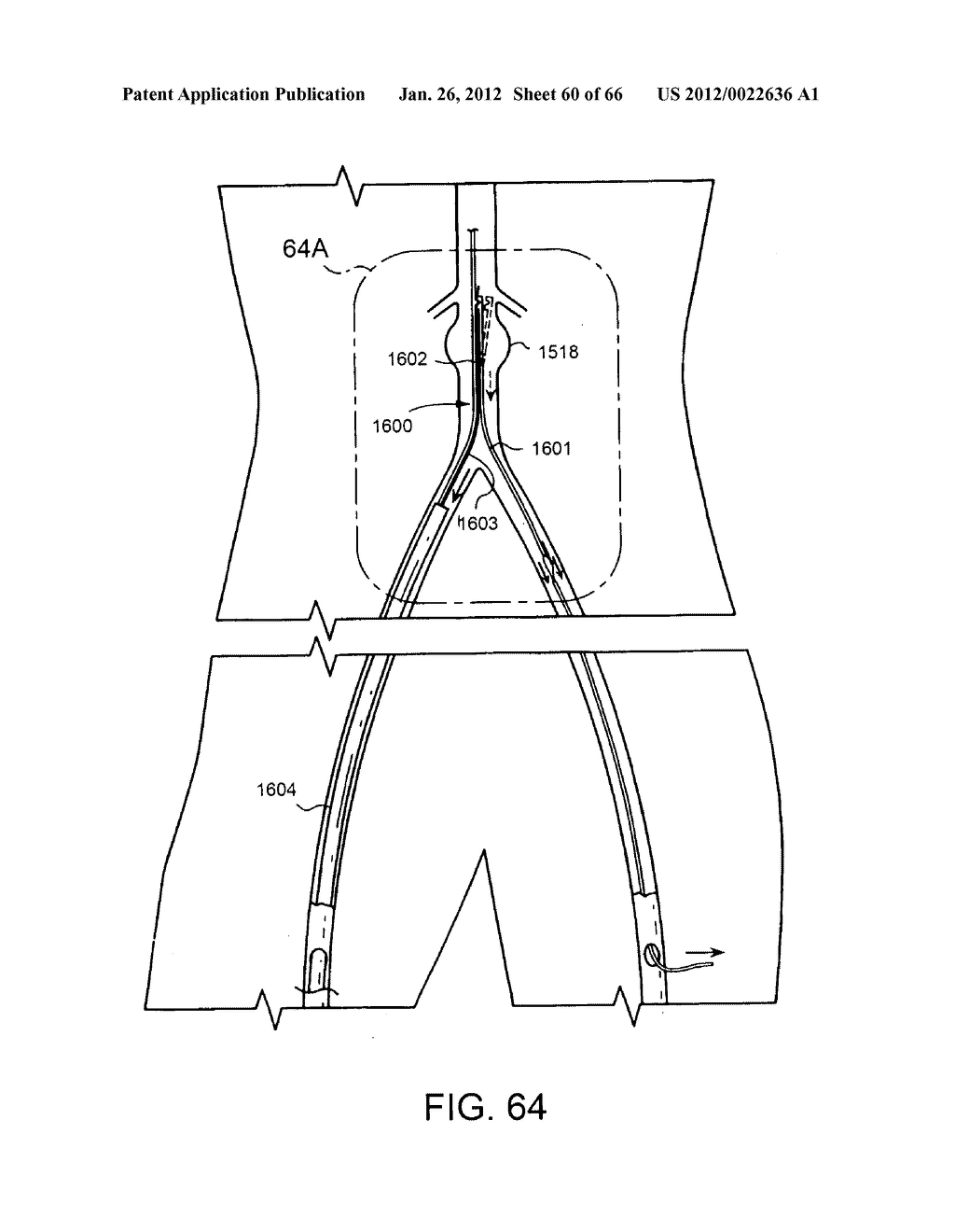 METHOD OF DELIVERING ADVANCED ENDOVASCULAR GRAFT - diagram, schematic, and image 61