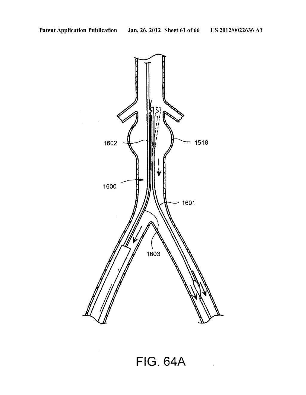 METHOD OF DELIVERING ADVANCED ENDOVASCULAR GRAFT - diagram, schematic, and image 62