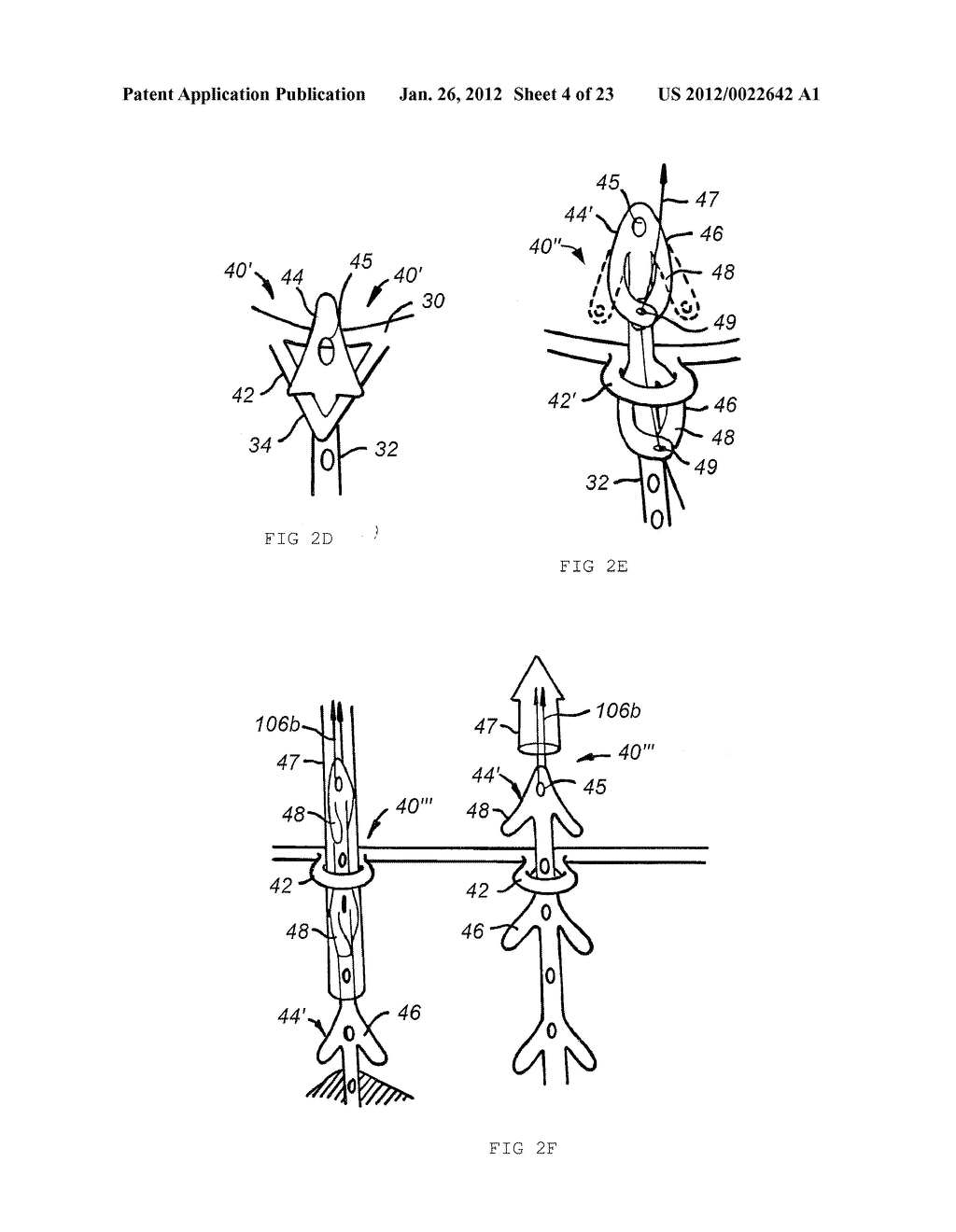 Methods and Apparatus for Endovascularly Replacing a Patient's Heart Valve - diagram, schematic, and image 05