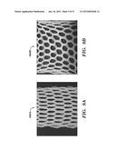 PROSTHETIC DEVICE AND METHOD OF USING IN BREAST AUGMENTATION AND/OR BREAST     RECONSTRUCTION diagram and image