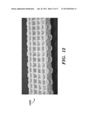 PROSTHETIC DEVICE AND METHOD OF USING IN BREAST AUGMENTATION AND/OR BREAST     RECONSTRUCTION diagram and image