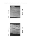 PROSTHETIC DEVICE AND METHOD OF USING IN BREAST AUGMENTATION AND/OR BREAST     RECONSTRUCTION diagram and image