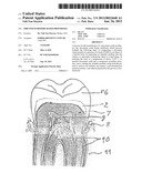 ZIRCONIUM DIOXIDE BASED PROSTHESES diagram and image