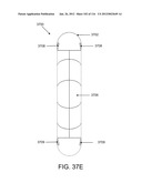 DISC-SHAPED ORTHOPEDIC DEVICES diagram and image