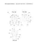 DISC-SHAPED ORTHOPEDIC DEVICES diagram and image