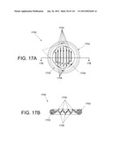 DISC-SHAPED ORTHOPEDIC DEVICES diagram and image