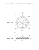 DISC-SHAPED ORTHOPEDIC DEVICES diagram and image