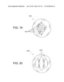 DISC-SHAPED ORTHOPEDIC DEVICES diagram and image