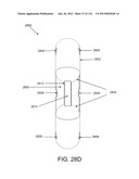 DISC-SHAPED ORTHOPEDIC DEVICES diagram and image