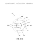 DISC-SHAPED ORTHOPEDIC DEVICES diagram and image