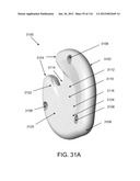 DISC-SHAPED ORTHOPEDIC DEVICES diagram and image