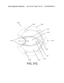 DISC-SHAPED ORTHOPEDIC DEVICES diagram and image