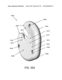 DISC-SHAPED ORTHOPEDIC DEVICES diagram and image