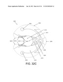 DISC-SHAPED ORTHOPEDIC DEVICES diagram and image