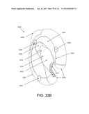 DISC-SHAPED ORTHOPEDIC DEVICES diagram and image