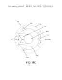 DISC-SHAPED ORTHOPEDIC DEVICES diagram and image