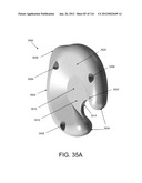 DISC-SHAPED ORTHOPEDIC DEVICES diagram and image