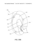 DISC-SHAPED ORTHOPEDIC DEVICES diagram and image