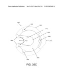 DISC-SHAPED ORTHOPEDIC DEVICES diagram and image