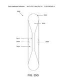 DISC-SHAPED ORTHOPEDIC DEVICES diagram and image