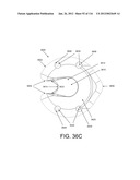 DISC-SHAPED ORTHOPEDIC DEVICES diagram and image