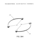 DISC-SHAPED ORTHOPEDIC DEVICES diagram and image