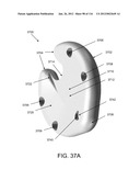 DISC-SHAPED ORTHOPEDIC DEVICES diagram and image