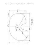 ASYMMETRIC TIBIAL COMPONENTS FOR A KNEE PROSTHESIS diagram and image