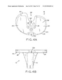 ASYMMETRIC TIBIAL COMPONENTS FOR A KNEE PROSTHESIS diagram and image