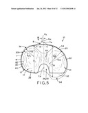 ASYMMETRIC TIBIAL COMPONENTS FOR A KNEE PROSTHESIS diagram and image