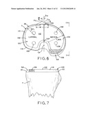 ASYMMETRIC TIBIAL COMPONENTS FOR A KNEE PROSTHESIS diagram and image