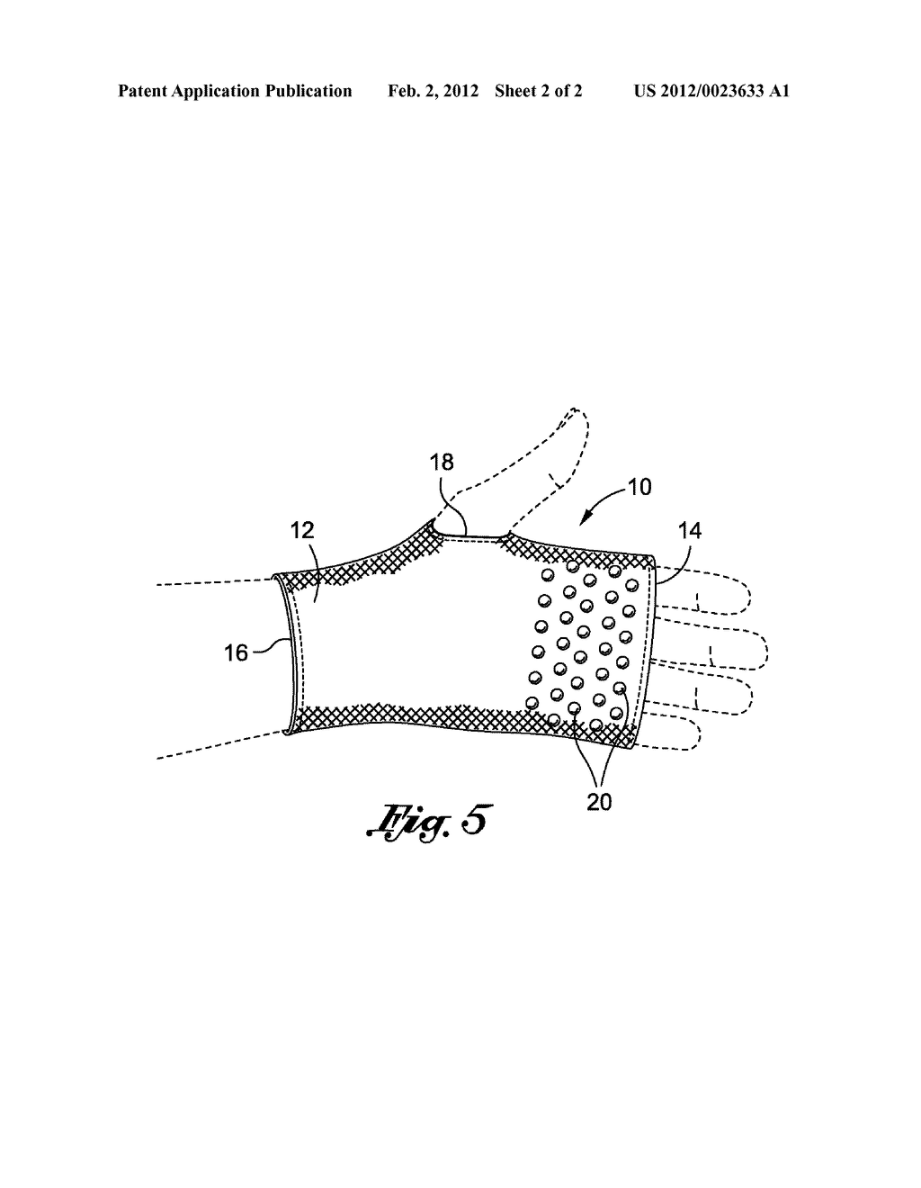 PROTECTIVE HAND GUARD - diagram, schematic, and image 03