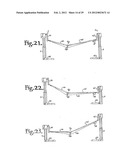 Patient positioning support structure diagram and image