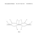 BRAIDED LOOP UTILIZING BIFURCATION TECHNOLOGY diagram and image