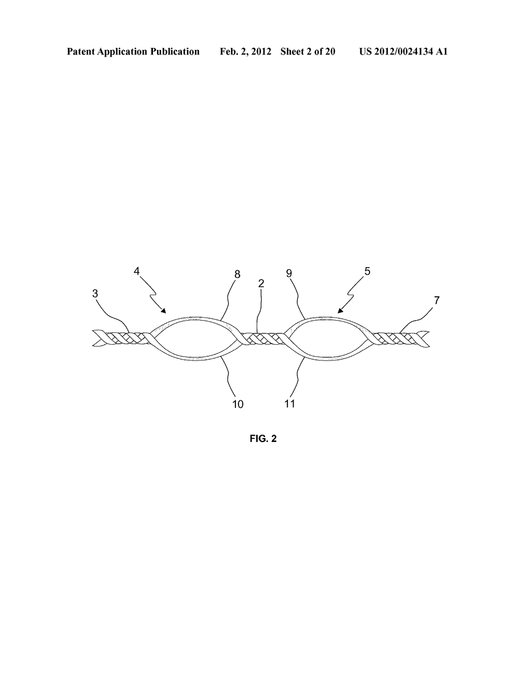 BRAIDED LOOP UTILIZING BIFURCATION TECHNOLOGY - diagram, schematic, and image 03