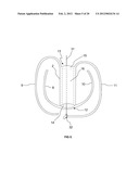 BRAIDED LOOP UTILIZING BIFURCATION TECHNOLOGY diagram and image