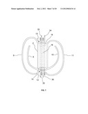 BRAIDED LOOP UTILIZING BIFURCATION TECHNOLOGY diagram and image