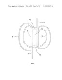 BRAIDED LOOP UTILIZING BIFURCATION TECHNOLOGY diagram and image